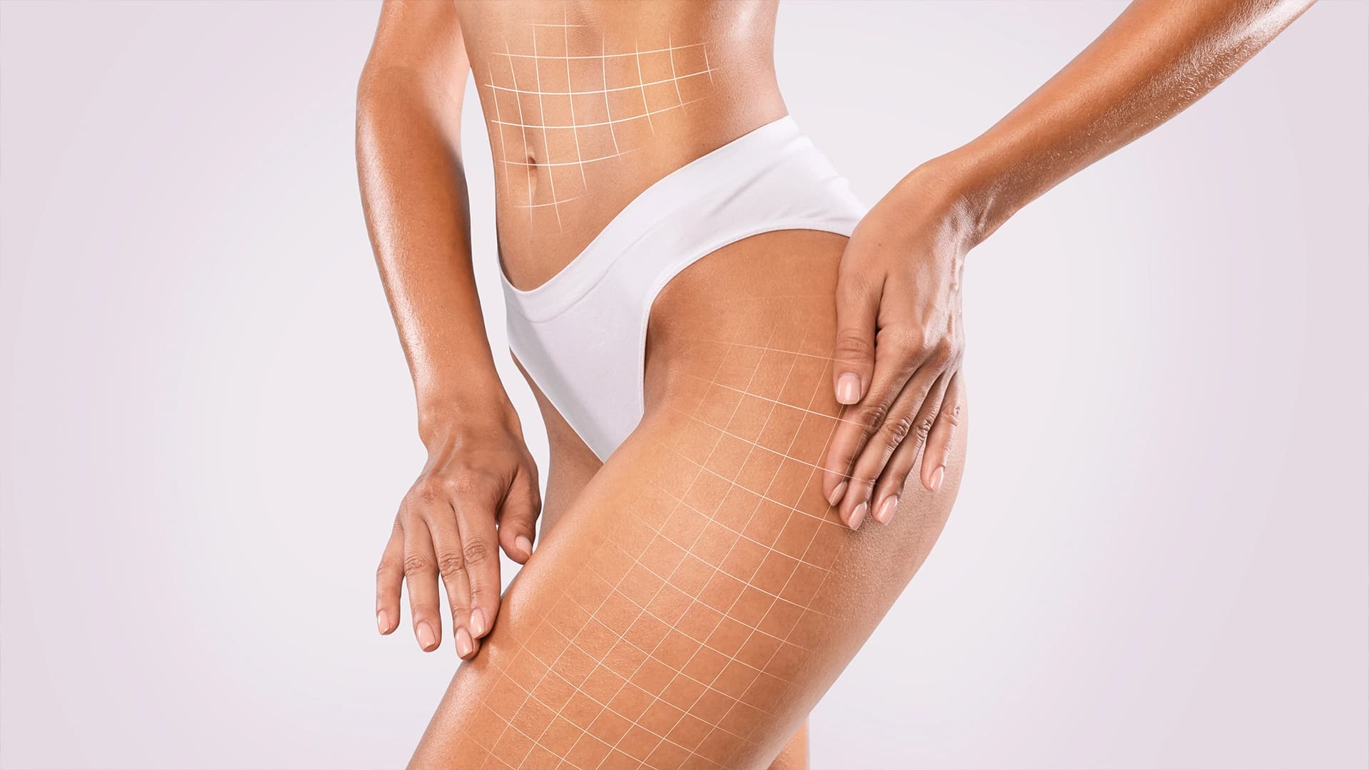 riduzione cellulite